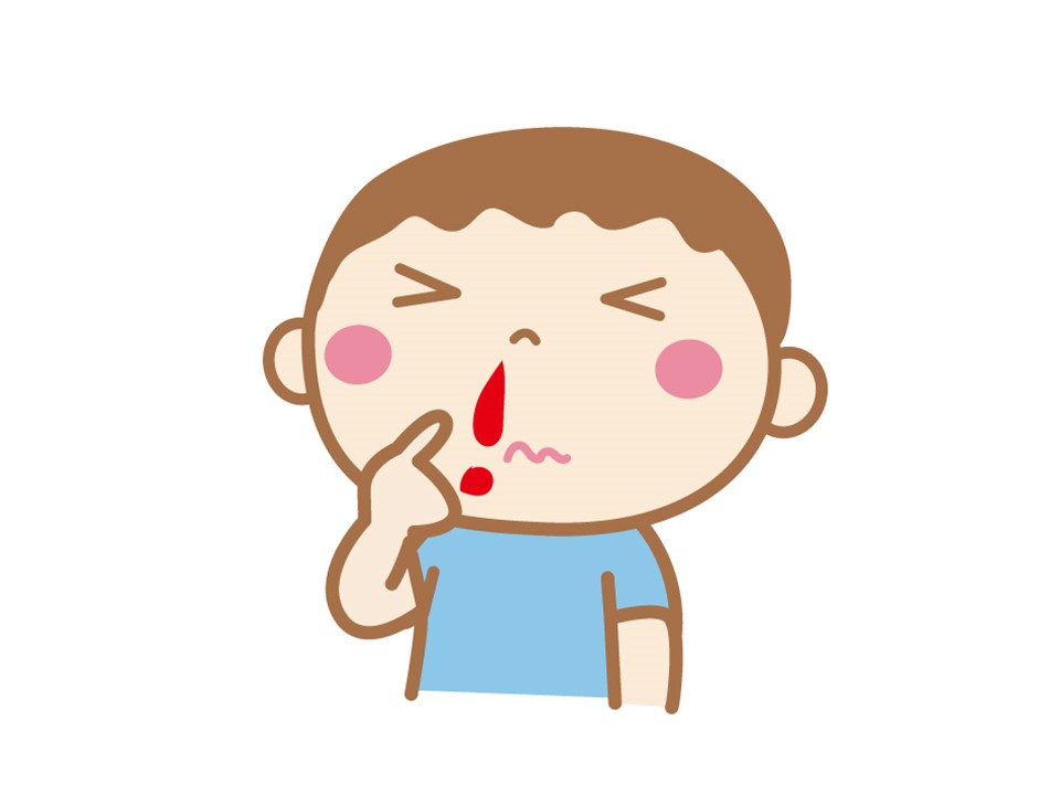 鼻血について