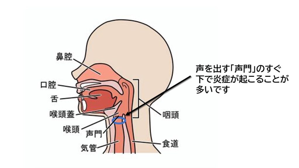 百日咳について