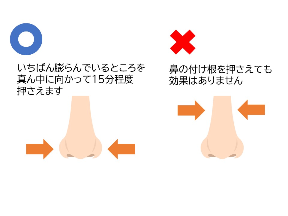 鼻血について２ - ブログ｜滋賀県守山市｜小児科・耳鼻咽喉科｜きどわき医院